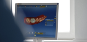 Zahnarztpraxis Juliusstrasse Wolfenbüttel - Cerec